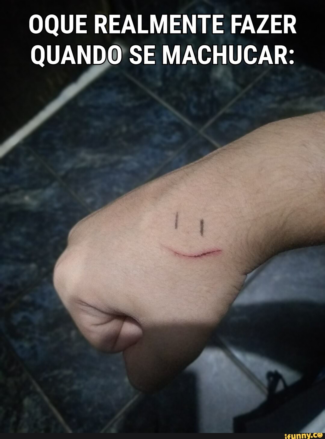 OQUE REALMENTE FAZER QUANDO SE MACHUCAR: