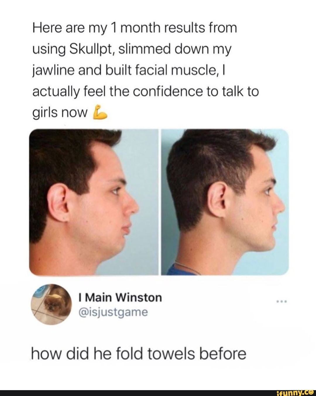 Here are my 1 month results from using Skullpt, slimmed down my jawline