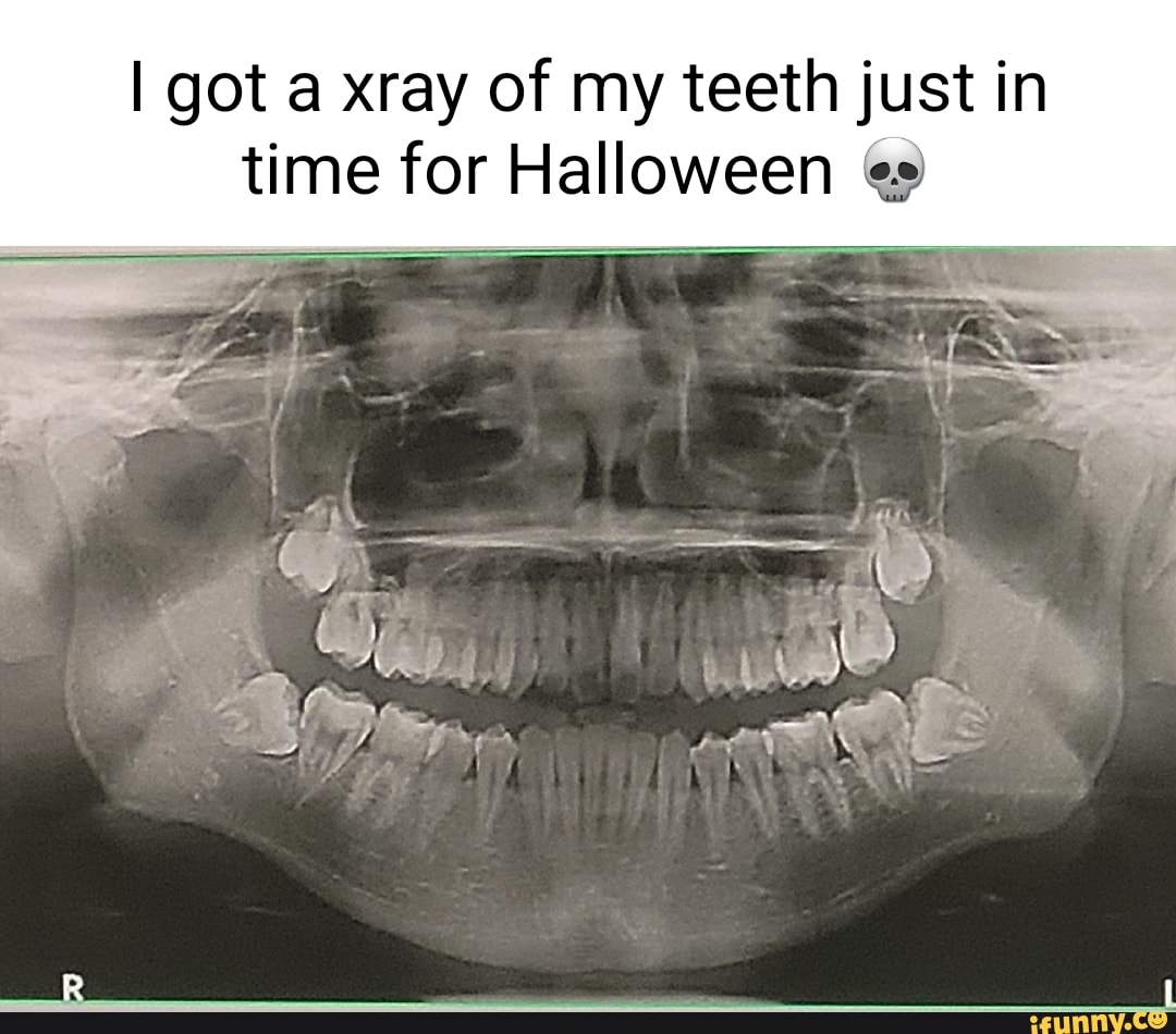 Wisdomtooth memes. Best Collection of funny Wisdomtooth pictures on iFunny  Brazil