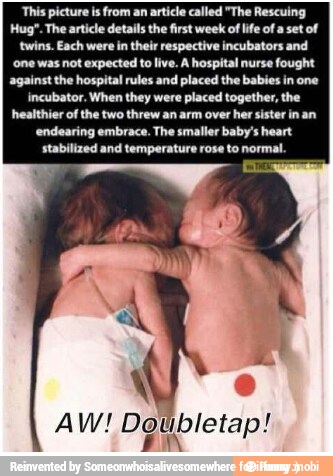 This picture is from an article called "The Rescuing
Hug". The article details the first week oflife of a set of
twins. Each were in their respective incubators and
one was not expected to live. À hospital nurse fought
against the hospital rules and placed the babies in one
incubator. When they were placed together, the
healthier of the two threw an arm over her sister inan
'endearing embrace. The smaller baby's heart
stabilized and temperature rose to normal.
AW! Dotibletap!