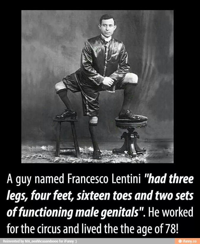A guy named Francesco Lentini "had three legs, four feet, sixteen toes