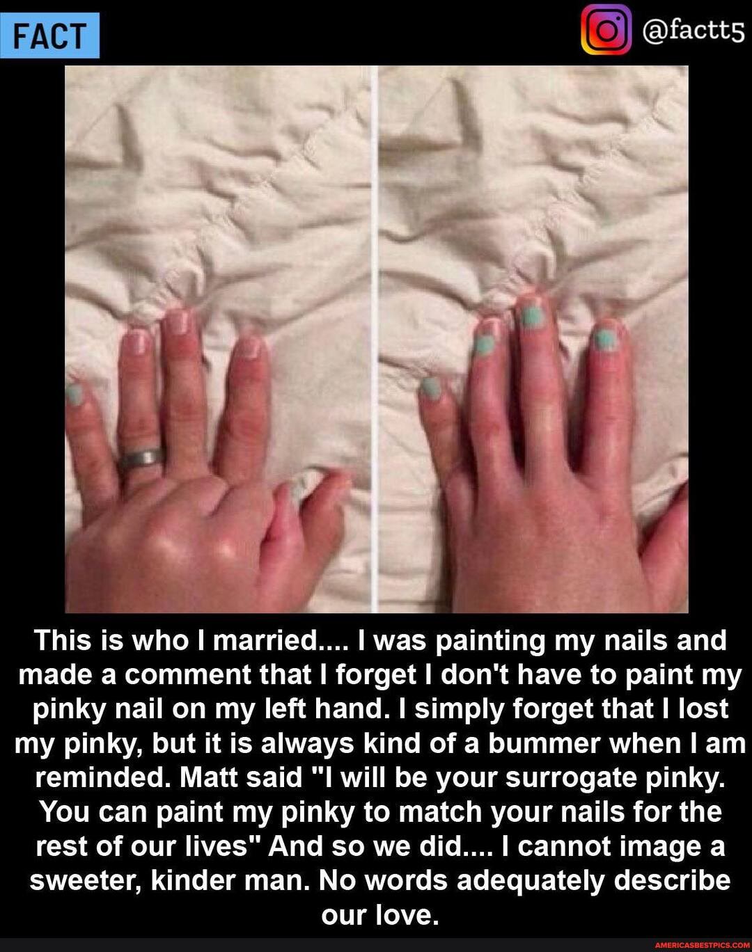 PACT
This is who I married.... I was painting my nails and made a comment that I forget I don't have to paint my pinky nail on my left hand. simply forget that I lost my pinky, but it is always kind of a bummer when I am reminded. Matt said "I will be your surrogate pinky.
You can paint my pinky to match your nails for the rest of our lives" And so we did.... I cannot image a sweeter, kinder man. No words adequately describe our love.