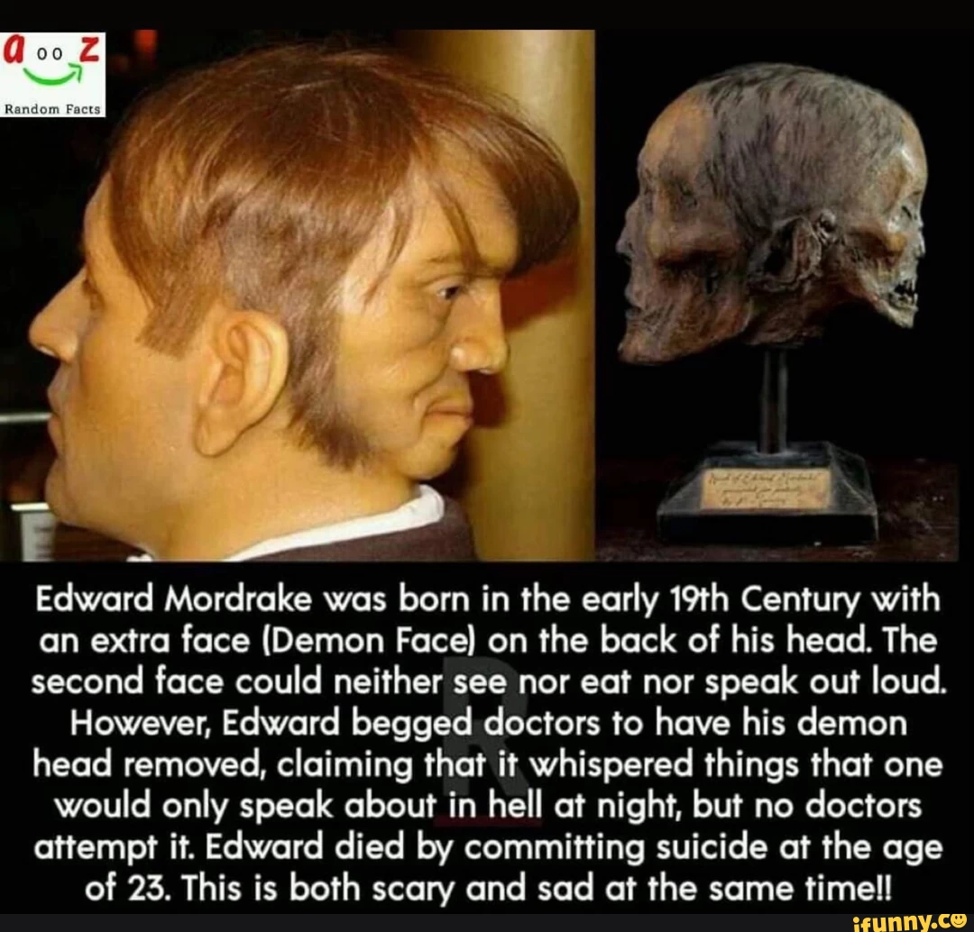 Edward Mordrake was born in the early 19th Century with an extra face (Demon Face) on the back of his head. The second face could neither see nor eat nor speak out loud. However, Edward begged doctors to have his demon head removed, claiming that it whispered things that one would only speak about in hell at night, but no doctors attempt it. Edward died by committing suicide at the age of 23. This is both scary and sad at the same timell