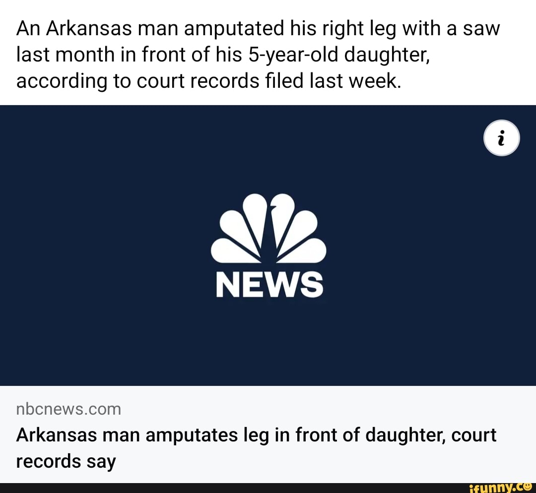 An Arkansas man amputated his right leg with a saw last month in front