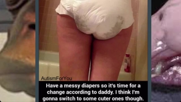 Messy diaper girls