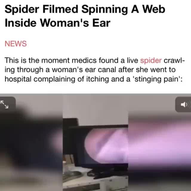 Spider Filmed Spinning A  Inside Woman's Ear NEWS This is the moment