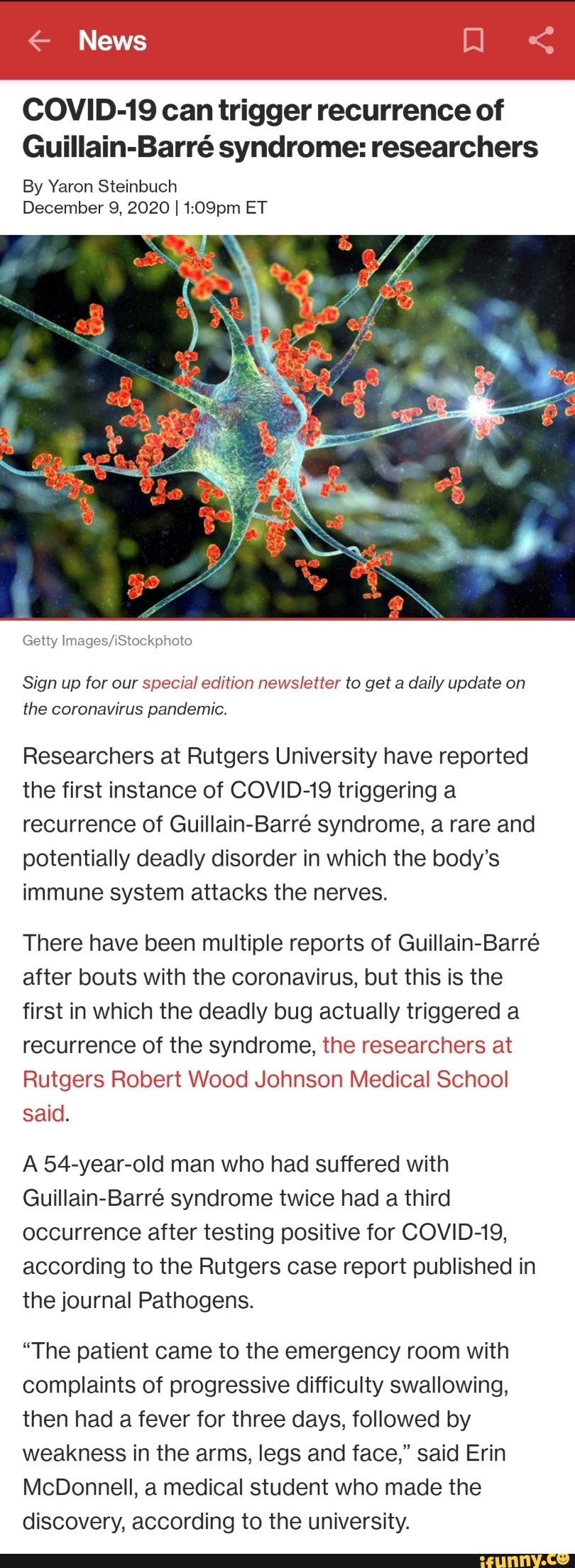 COVID-19 Can Trigger Recurrence Of Guillain-Barr Syndrome: Researchers ...