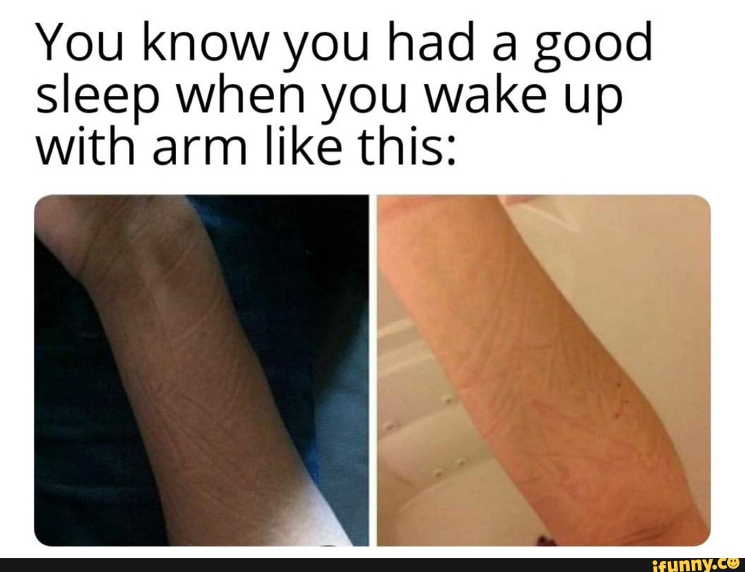 You know you had a good sleep when you wake up with arm like this: