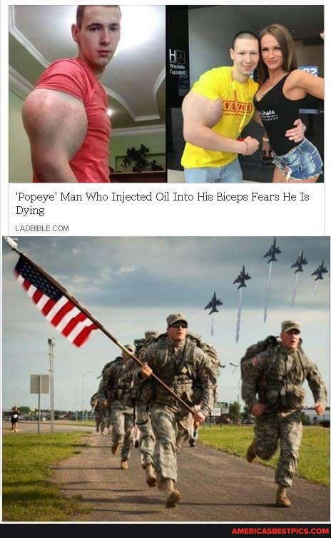 en i
'Popeye' Man Who Injected Oil Into His Biceps Fears He Is
Dying