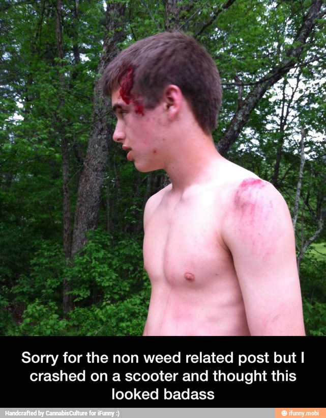 Sorry for the non weed related post but I
crashed on a scooter and thought this
looked badass - Sorry for the non weed related post but I crashed on a scooter and thought this looked badass