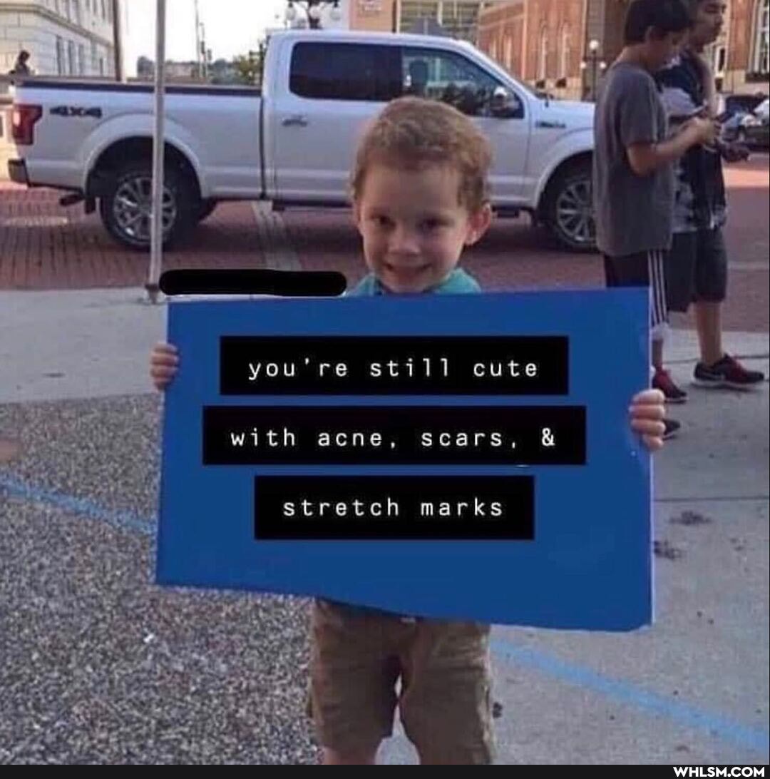 you're still cute
with acne, scars,
stretch marks