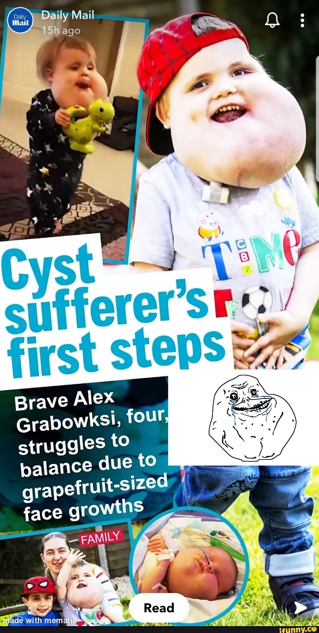 Daily Mail
ago
Cyst
first stepS
Brave Alex
Grabowksi, four, struggles to balance due to
-sized face growths
FAMILY AZ