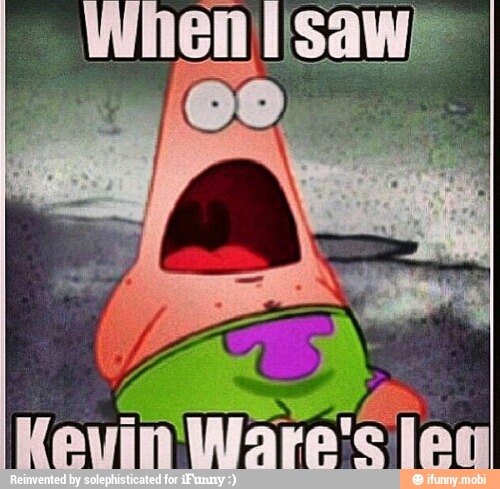 As
Kevin Ware'c leg