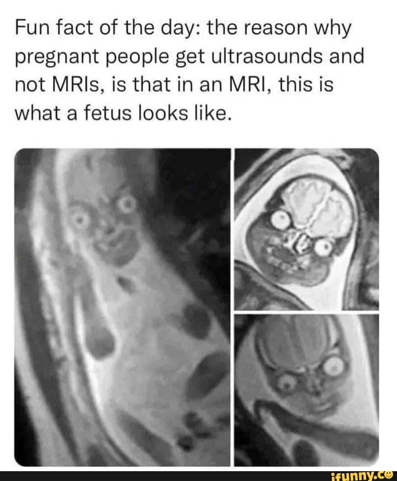 Ultrasounds memes. Best Collection of funny Ultrasounds pictures on iFunny