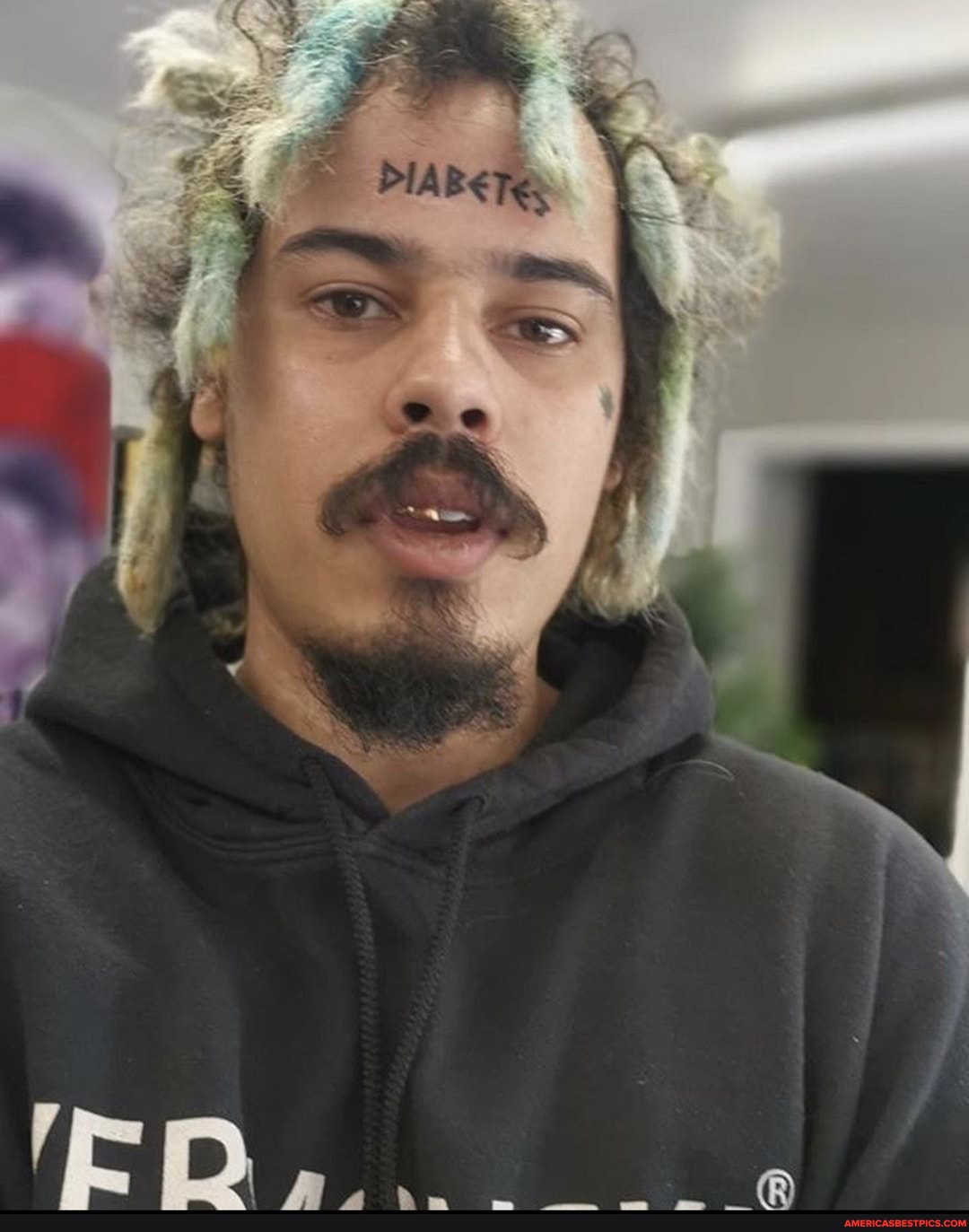 swedish, rapper, bud, stankz, tattooed, diabetes, forehead, raise, awarenes