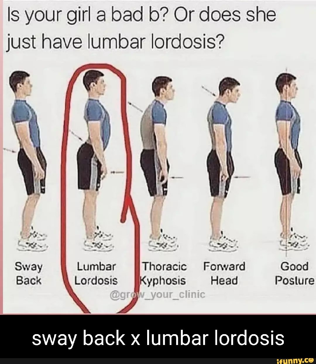 Is Your Girl A Bad B? Or Does She Just Have Lumbar Lordosis? II Sway II ...