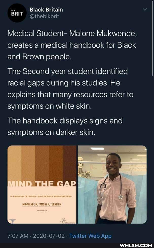 Black Britain
BRIT @thebikbrit
Medical Student- Malone Mukwende, creates a medical handbook for Black and Brown people.
The Second year student identified racial gaps during his studies. He explains that many resources refer to symptoms on white skin.
The handbook displays signs and symptoms on darker skin.
P, TURNER
AM - 2020-07-02 - Twitter Web Aan