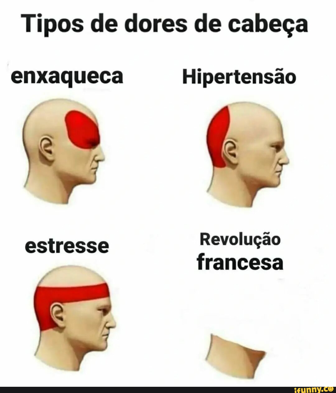 Tipos De Dores De Cabeça Enxaqueca Hipertensão Estresse Revolução Francesa Ifunny Brazil