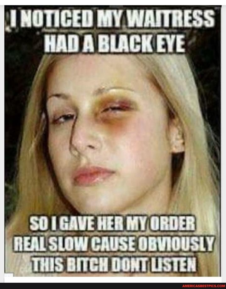 TNOTICED MY WAITRESS HAD A BLACK EVE