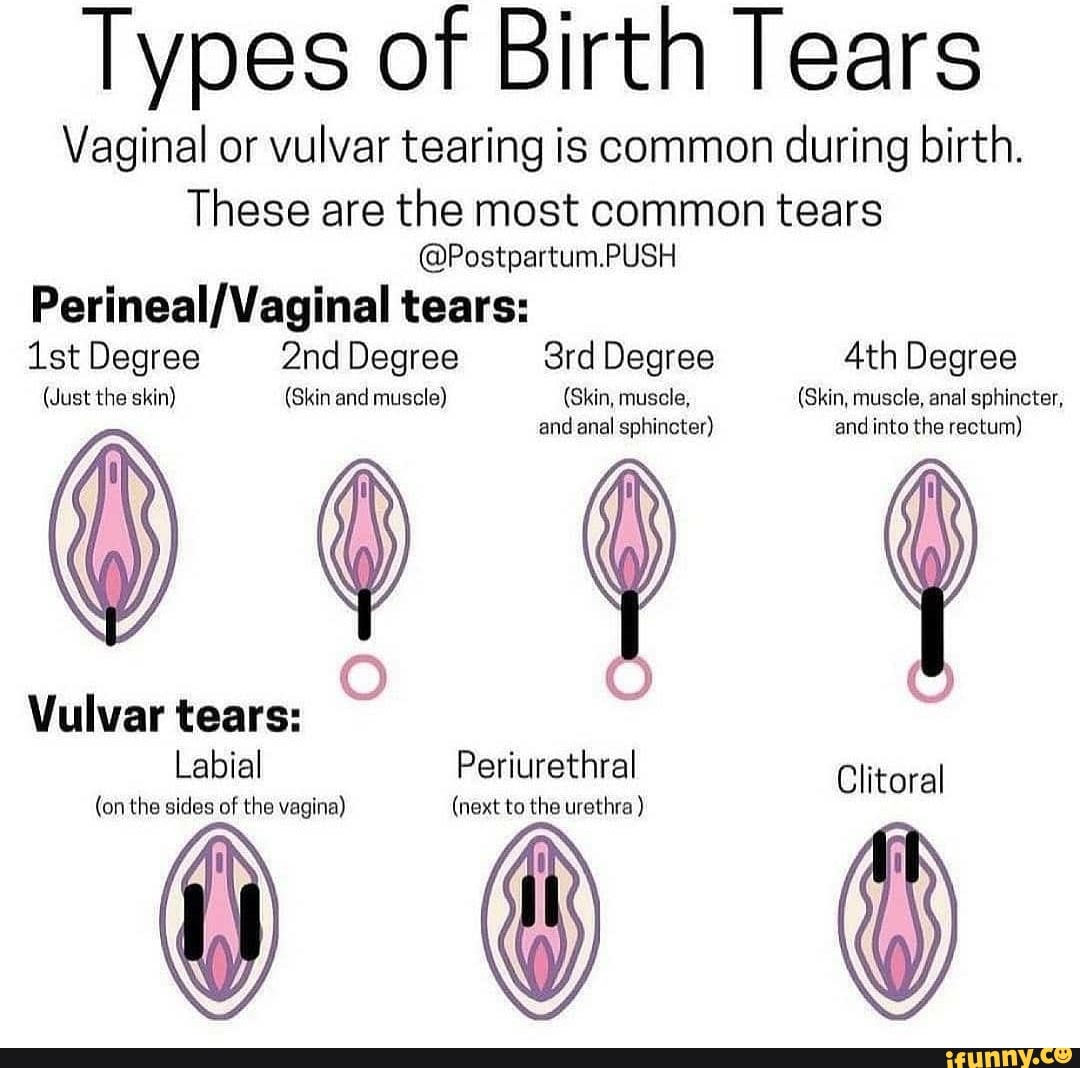 Vulvar Memes Best Collection Of Funny Vulvar Pictures On Ifunny