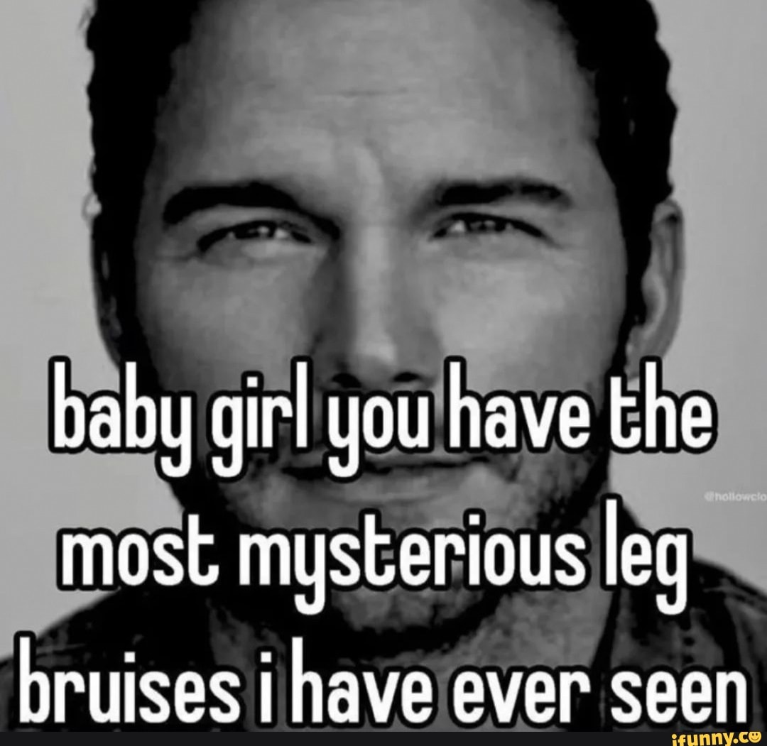 Baby girl you have the most mysterious leg bruises ihave ever seen iFunny