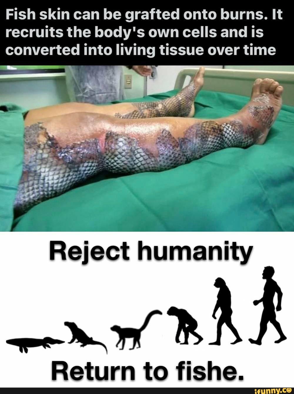 Fish skin can be grafted onto burns. It recruits the body's own cells and is converted into living tissue over time
Reject humanity
Return to fishe.