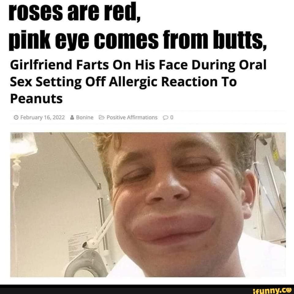 Roses are red, pink eye comes from butts, Girlfriend Farts On His Face During Oral Sex Setting Off Allergic Reaction To Peanuts February 16,2022 and Bonine Positive Affirmations pic image