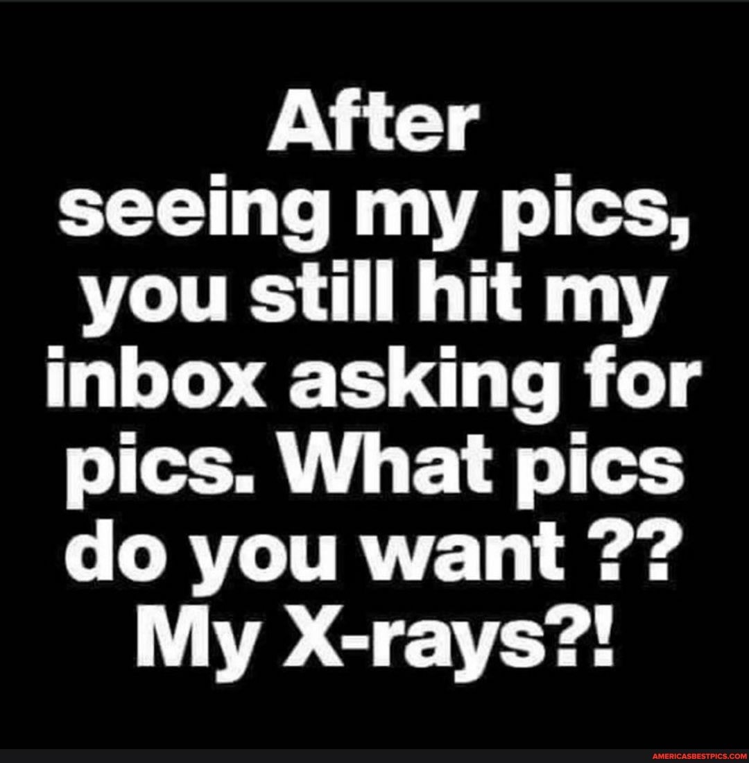 After seeing my pics, you still hit my inbox asking for pics. What pics do you want
My X-rays?!