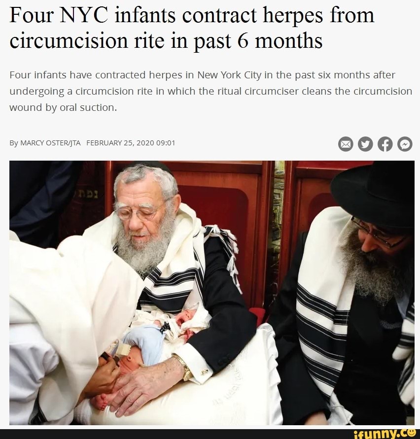 Four Nyc Infants Contract Herpes From Circumcision Rite In Past 6 Months Four Infants Have 5592