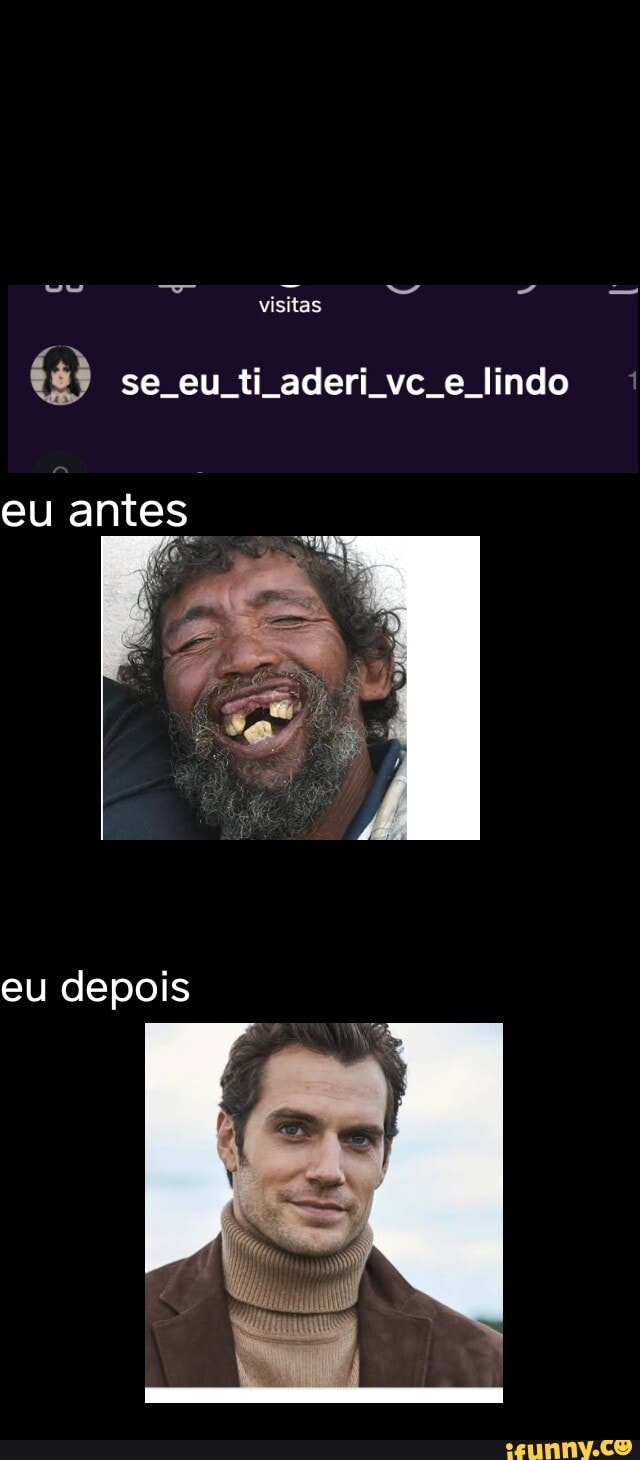 visitas
se eu ti aderi vc e lindo
eu antes
eu depois