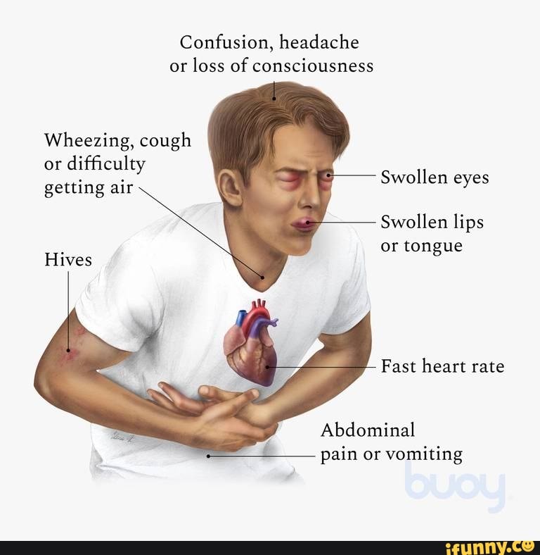 Confusion, headache or loss of consciousness Wheezing, cough or