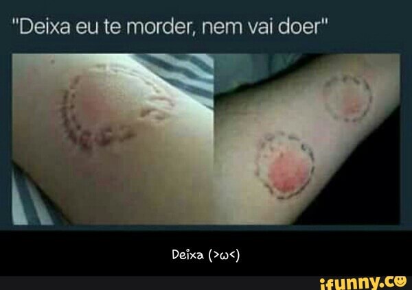 "Deixa eu te morder, nem vai doer" - Deixa (>ω<)