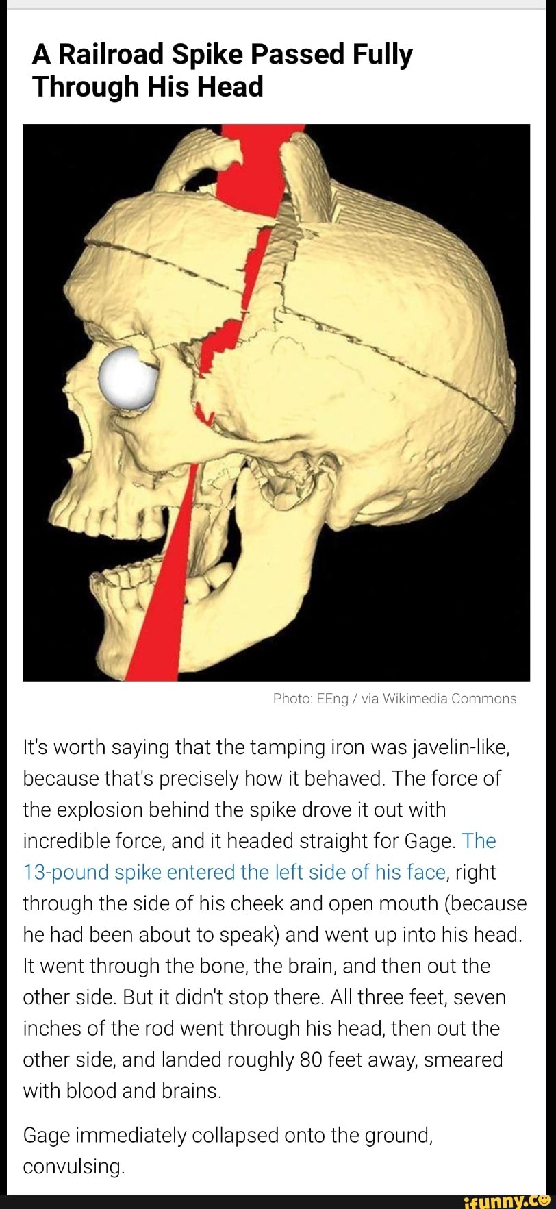 A Railroad Spike Passed Fully Through His Head Wikimedia Commons Its