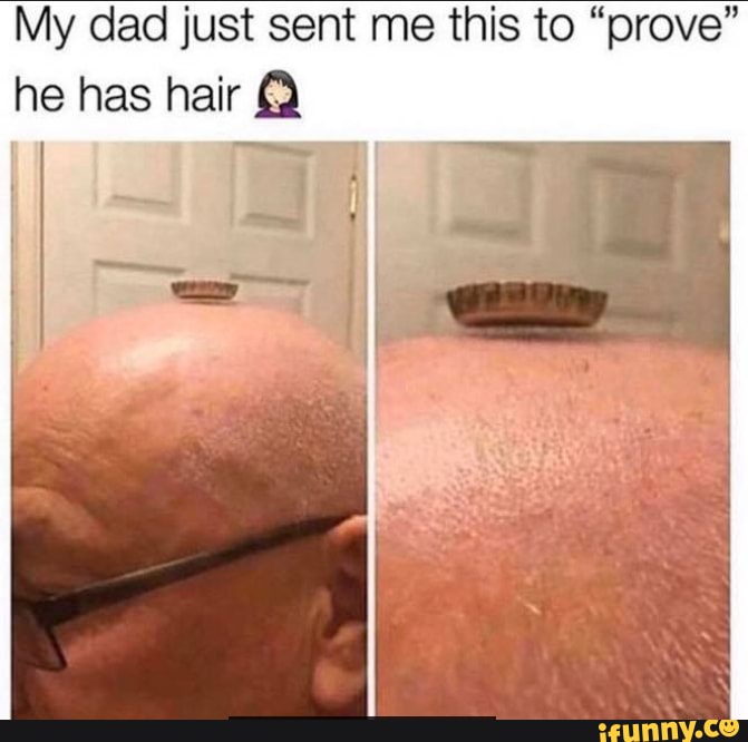 My dad just sent me this to "prove" he has hair