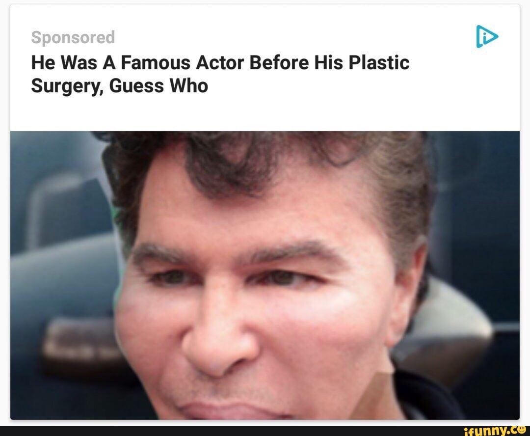 He Was A Famous Actor Before His Plastic Surgery, Guess Who - iFunny