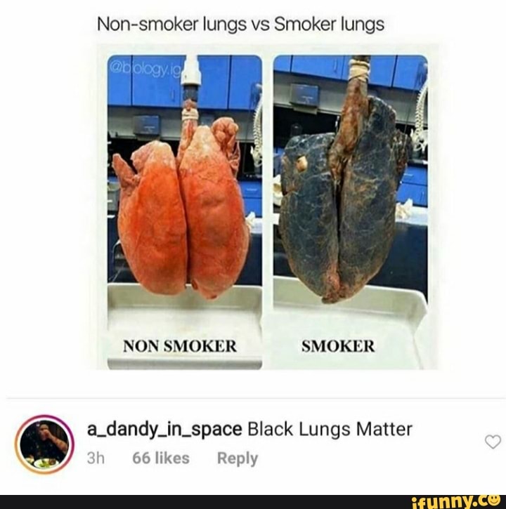 Nonsmoker lungs vs Smoker lungs NON SMOKER SMOKER a_dandy