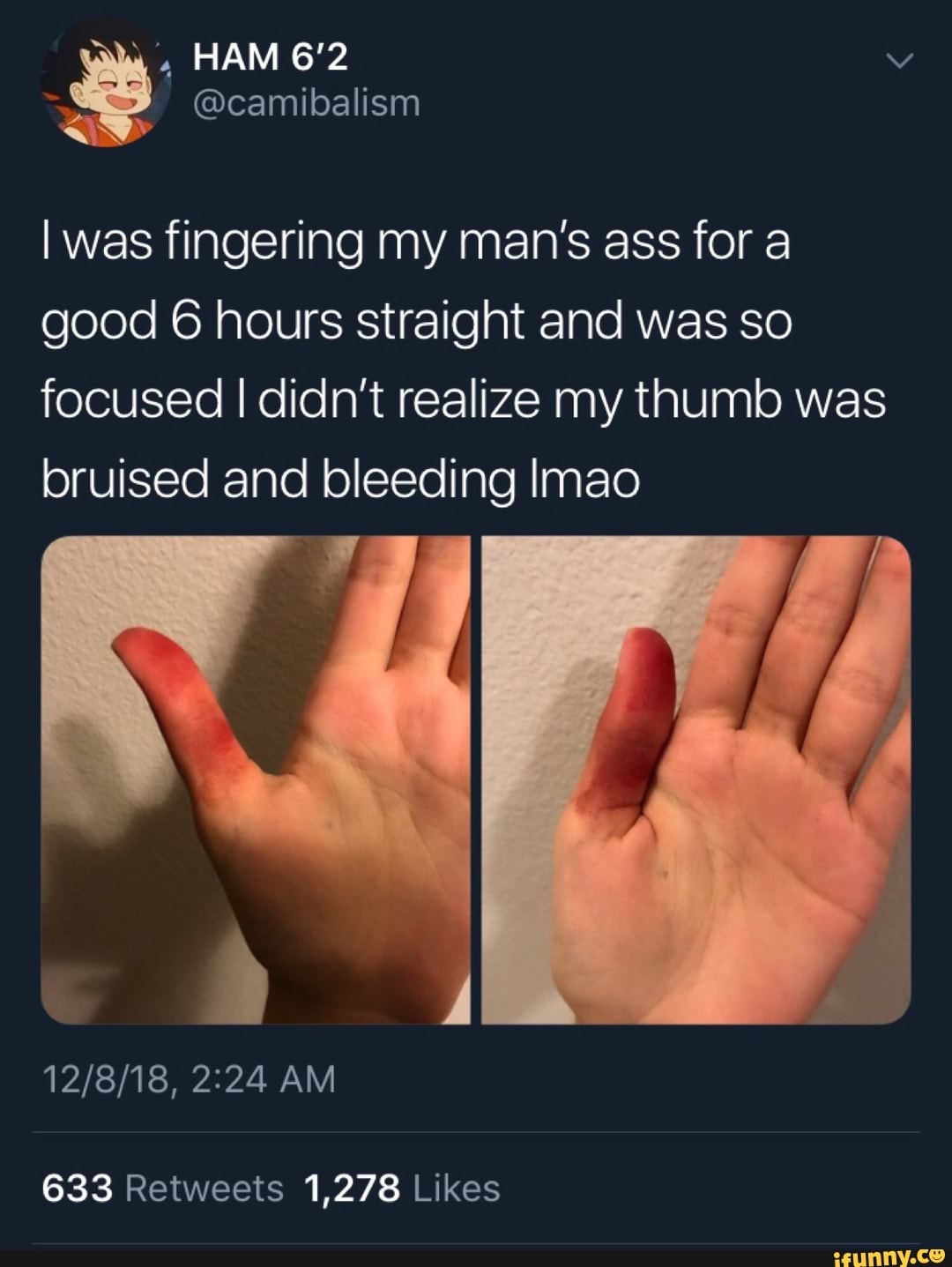 Girl fingers mans ass