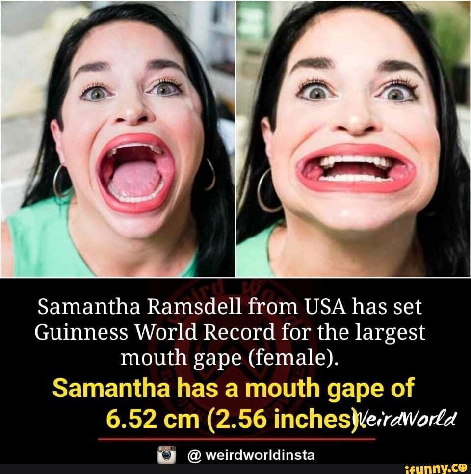 Samantha Ramsdell From USA Has Set Guinness World Record For The Largest Mouth Gape Female