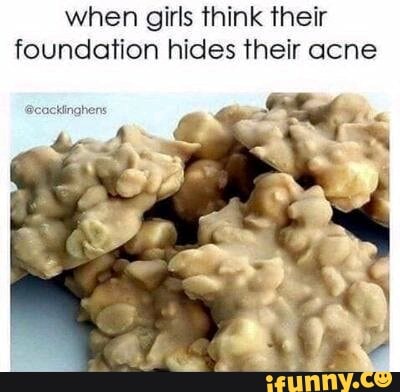 when girls think their foundation hides their acne
@cackinghens