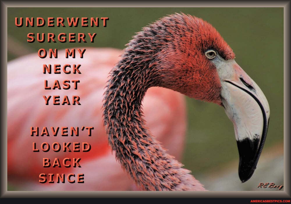 UNDERWENT SURGERY I ON MY NECK LAST YEAR
HAYEN'T LOOKED