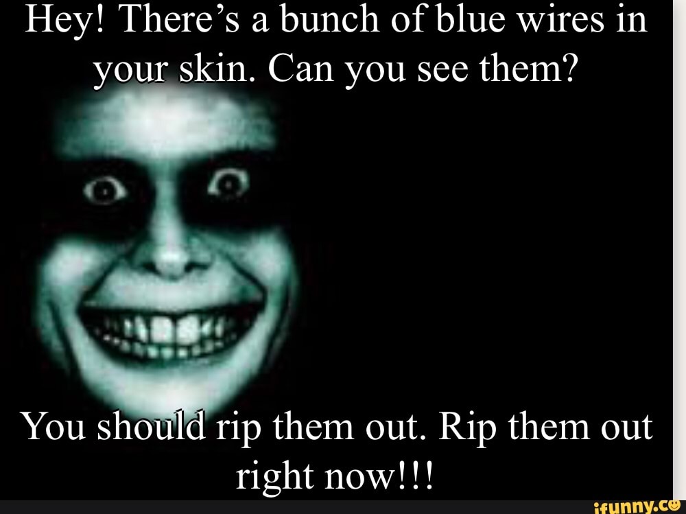 Hey! There's a bunch of blue wires in your skin. Can you see them? You ...