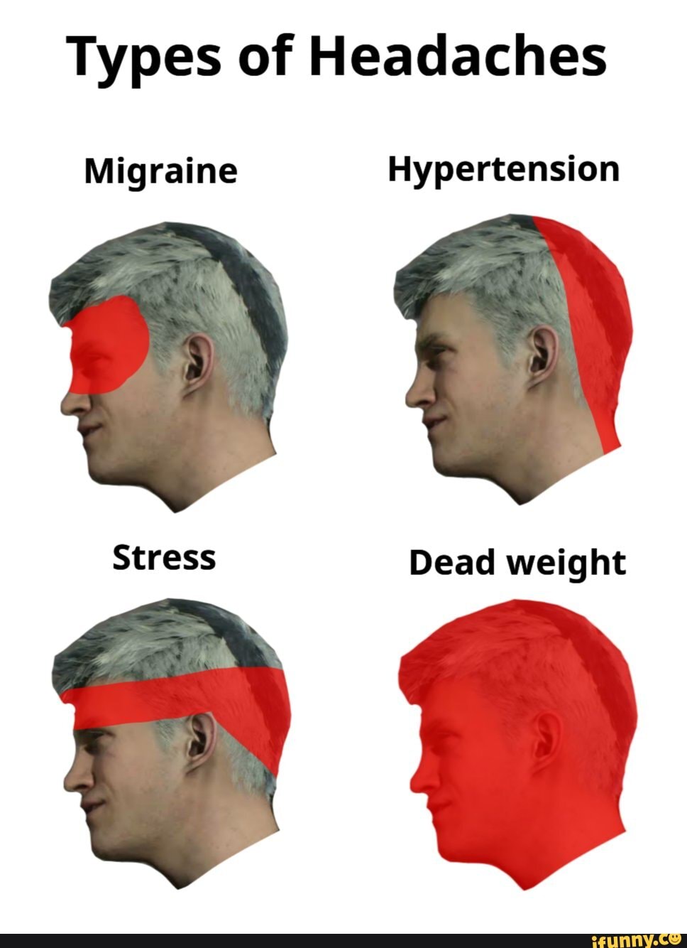 Types of Headaches Migraine Hypertension Stress Dead weight - iFunny