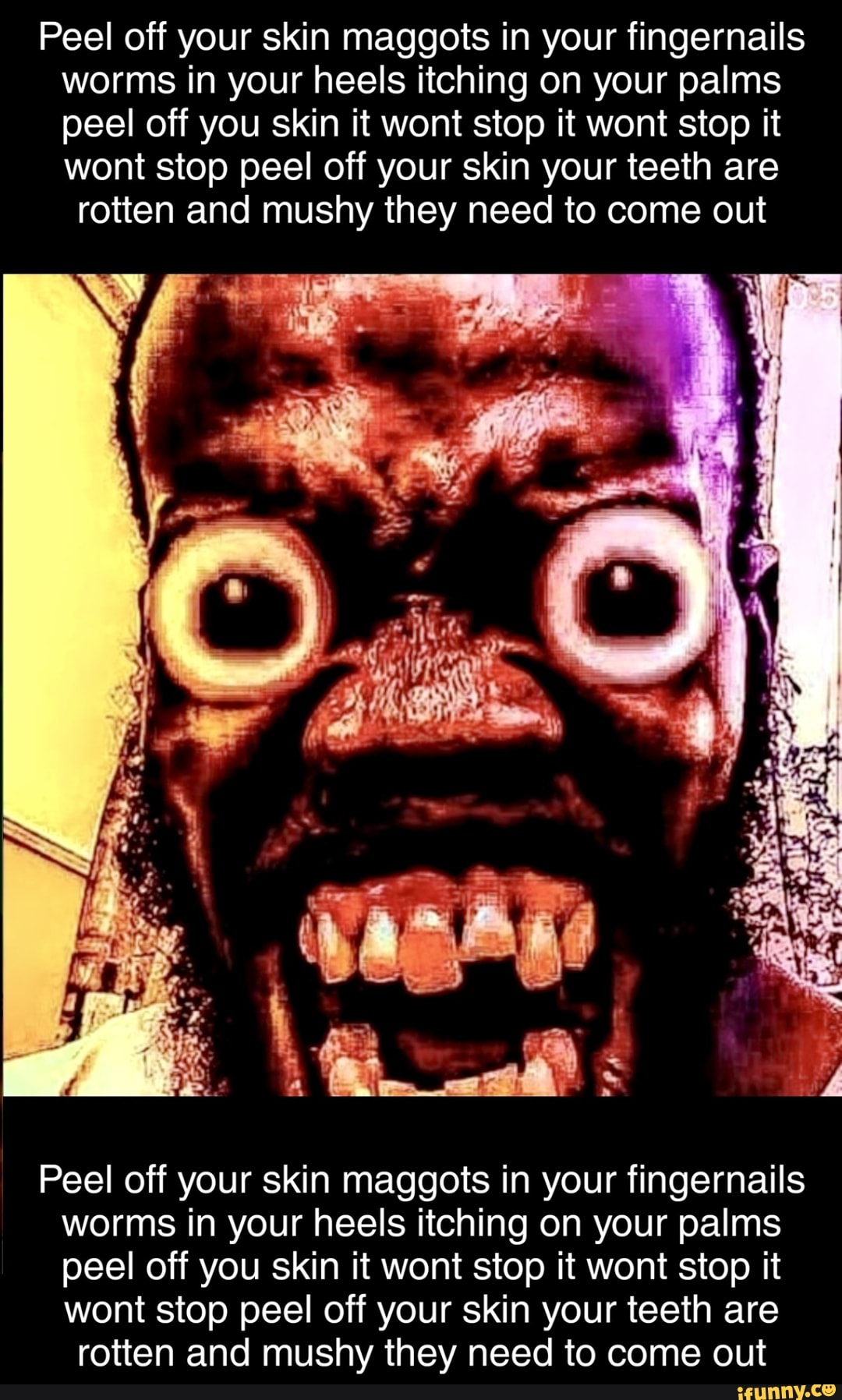 Peel off your skin maggots in your fingernails worms in your heels