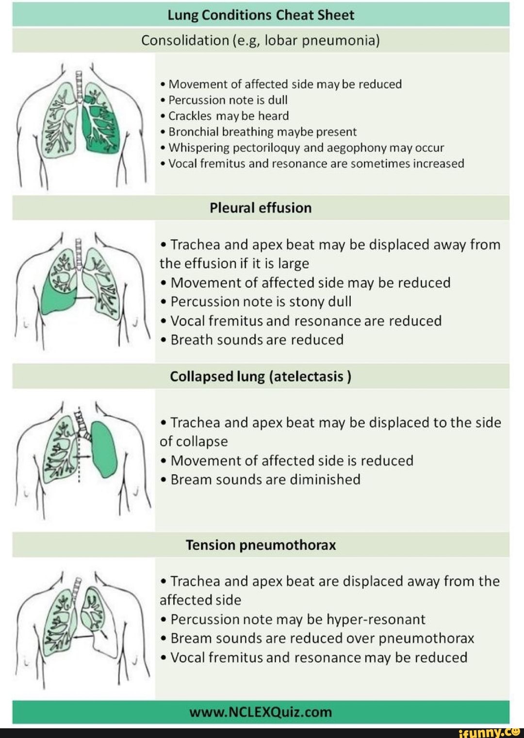 aspiration pneumonia lung sounds