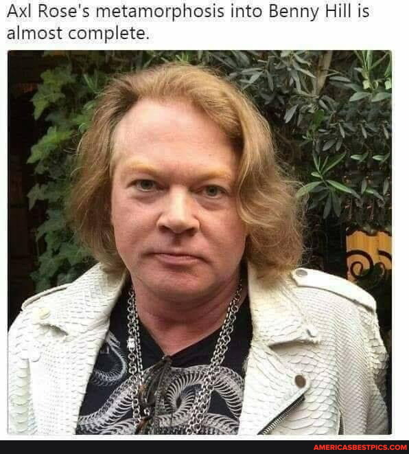 Axl Rose's metamorphosis into Benny Hill is almost complete - America’s ...
