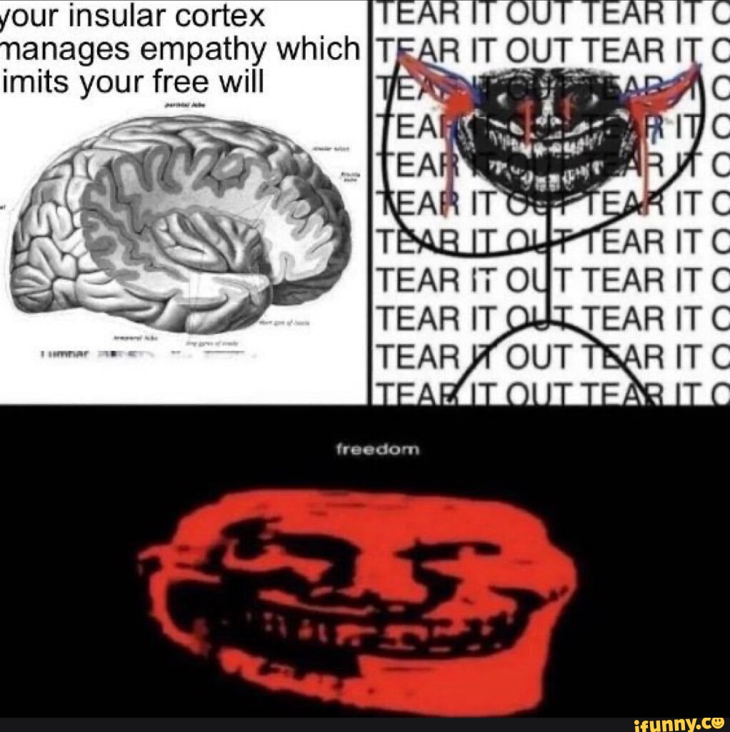 Auditory Cortex Memes Establishing The Roles Of The Dorsal And Ventral