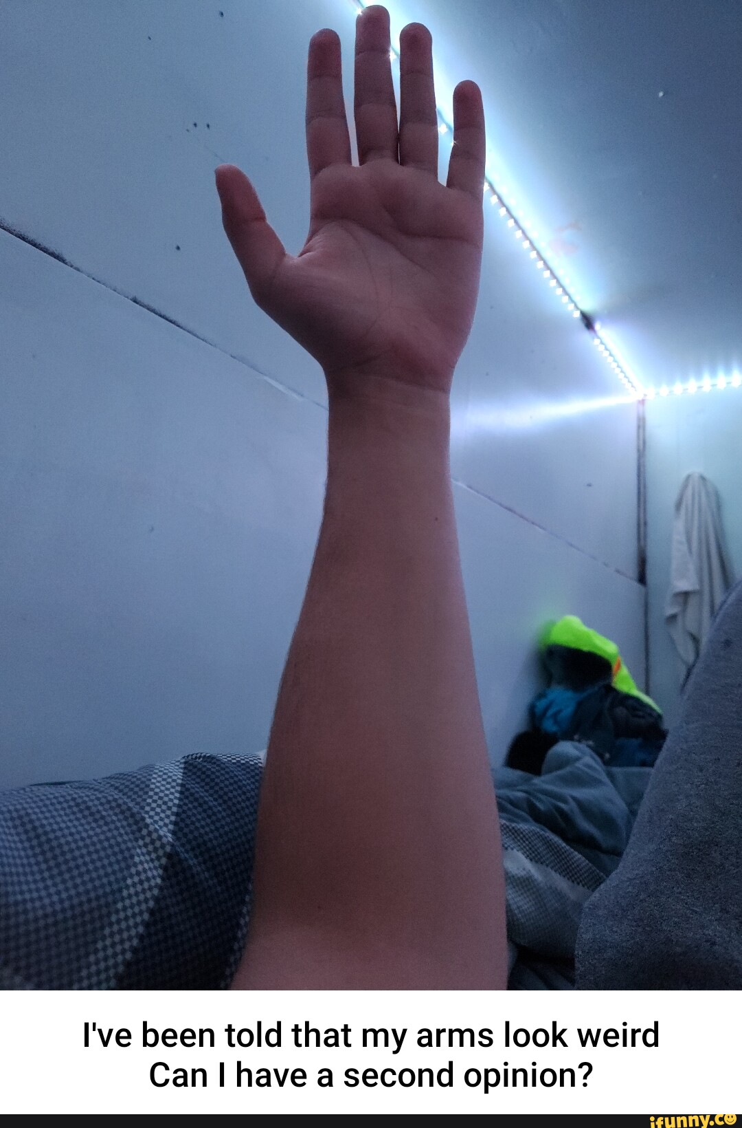 I've been told that my arms look weird Can I have a second opinion ...