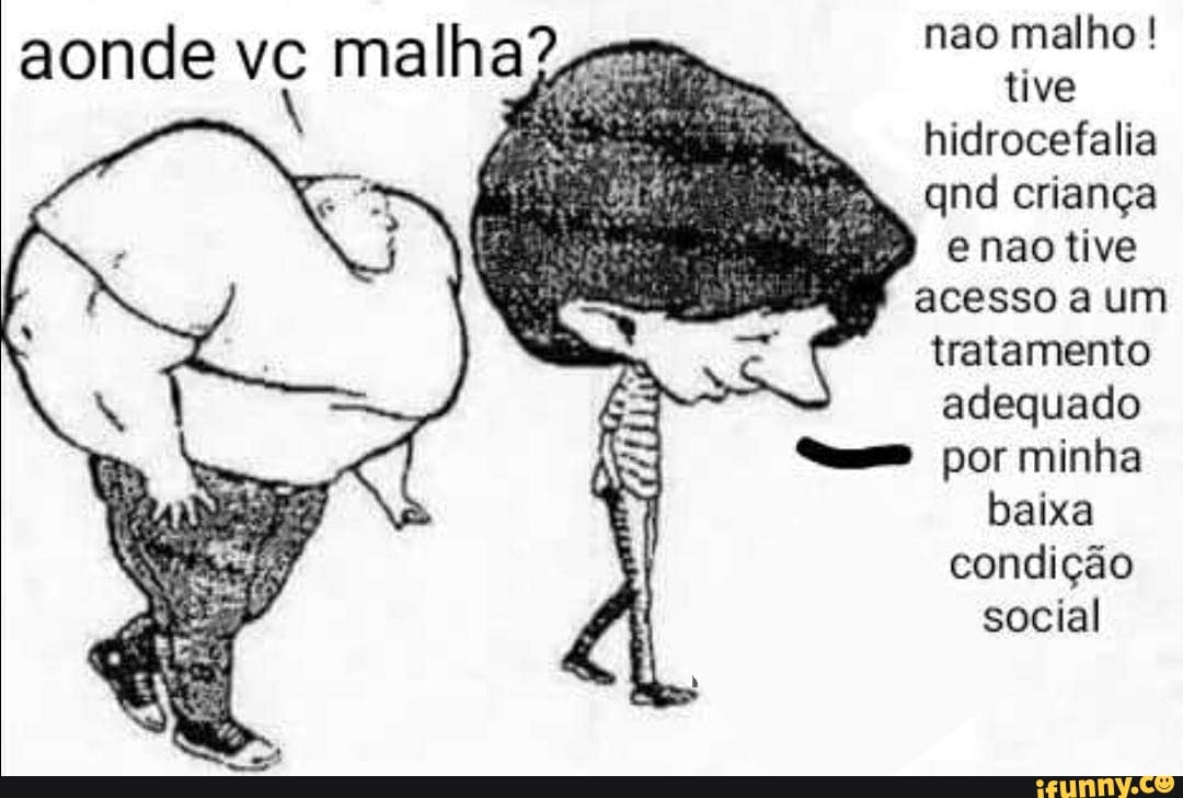 tive
a
hidrocefalia
REA
© nao tive
acesso a um
tratamento
adequado
baixa
condição