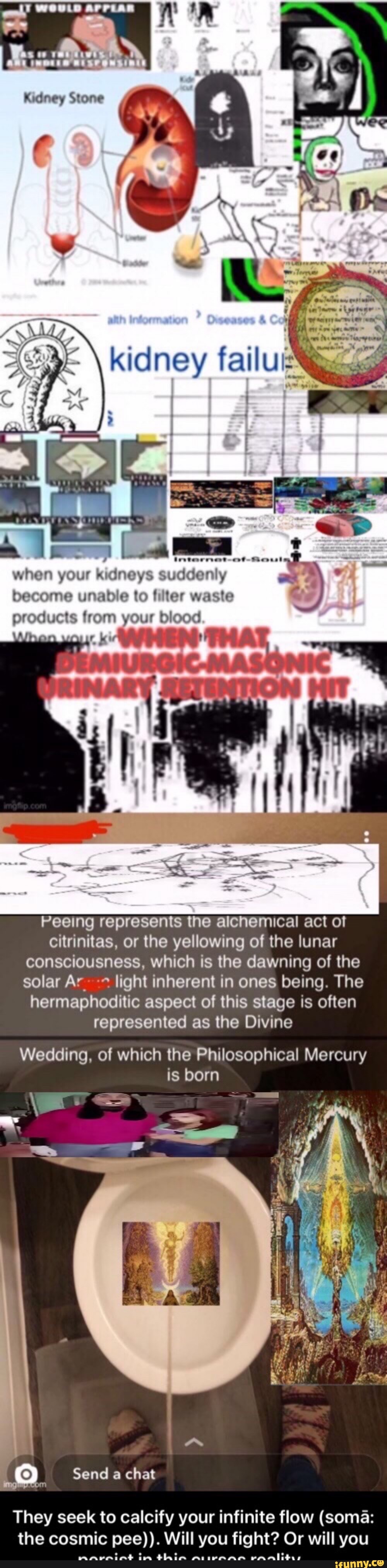 ant format"
kidney
when your kidneys suddenly become unable to filter waste products from your blood
A rk
Peeing represents the alchemical act of citrinitas, or the yellowing of the lunar consciousness, which is the dawning of the solar Ar_ light inherent in ones being. The hermaphoditic aspect of this stage is often represented as the Divine
Wedding, of which the Philosophical Mercury is born
2. Send a chat
They seek to calcify your infinite flow (soma: the cosmic pee)). Will you fight? Or will you