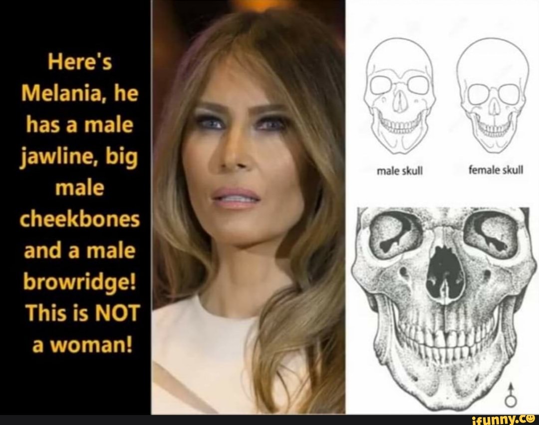 Here's Melania, he has a male jawline, big male skull female skull male